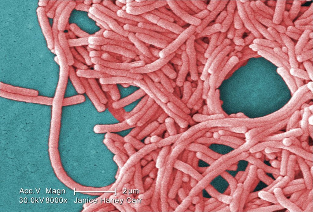 LTC the overwhelming source of Legionnaires’ in healthcare facilities, CDC says