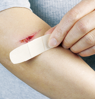 Antimicrobial spray may reduce wound pain during healing better than traditional dressings.