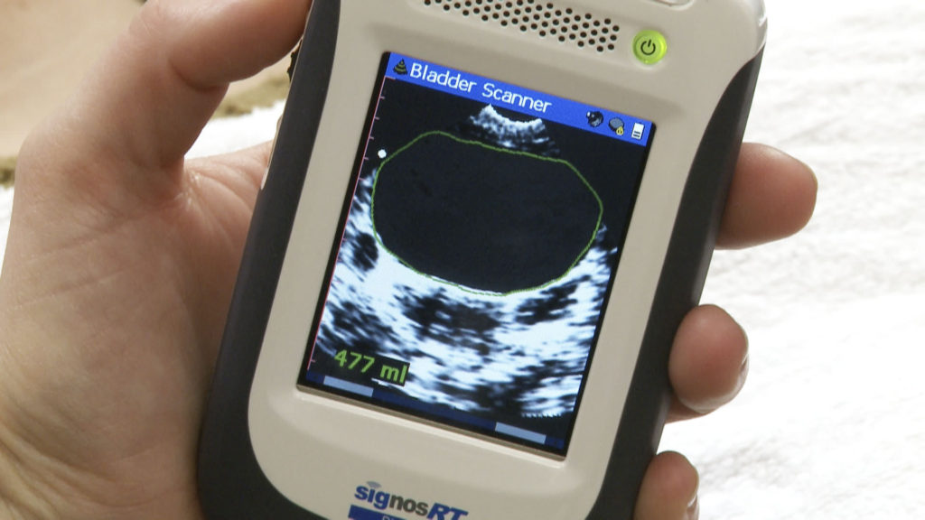 Handheld bladder scanner approved