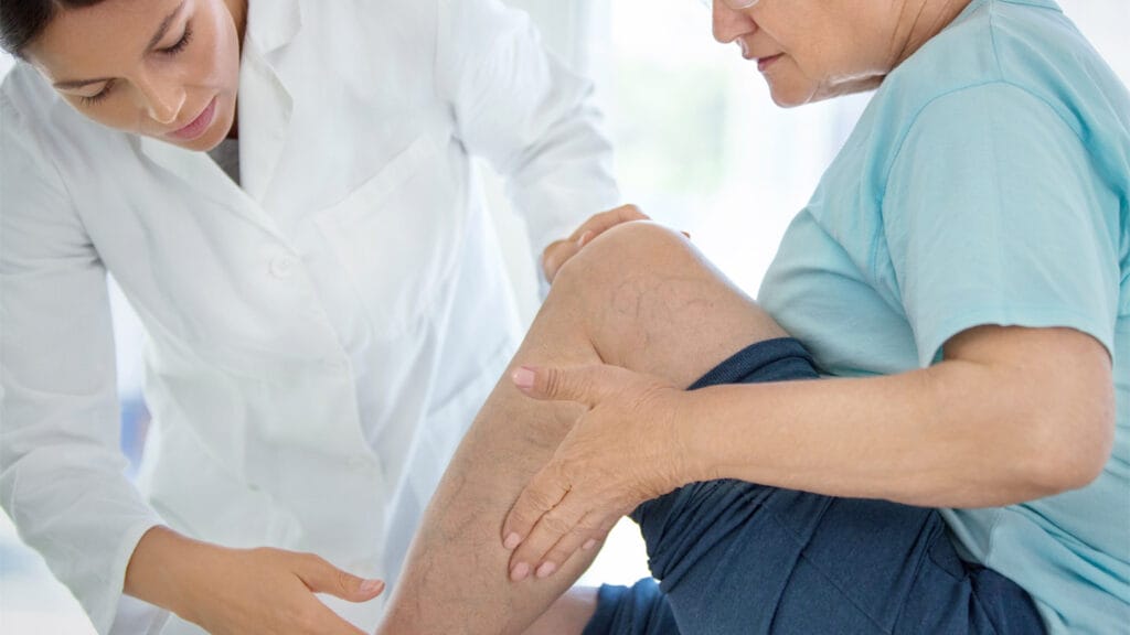 Accellular matrices may help healing of venous leg ulcers